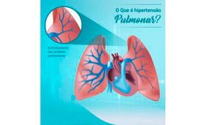 Atenção para a Hipertensão Arterial Pulmonar